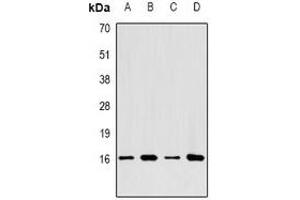 Western blot analysis of LC3A expression in SHSY5Y (A), HepG2 (B), BT474 (C), mouse brain (D) whole cell lysates. (MAP1LC3A Antikörper)
