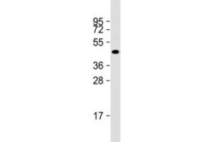 Western blot testing of human A549 cell lysate with NAT16 antibody at 1:2000. (NAT16 Antikörper  (AA 12-46))