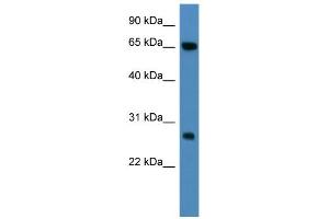 WB Suggested Anti-KBTBD8 Antibody Titration: 0. (KBTBD8 Antikörper  (N-Term))