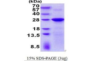 Lin-7 Homolog C (LIN7C) protein (His tag)