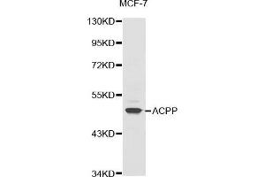 Western blot analysis of extracts of MCF-7 cell line, using ACPP antibody.
