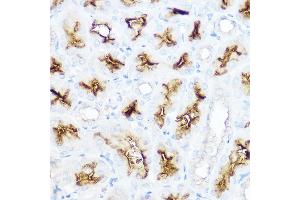 Immunohistochemistry (IHC) image for anti-Alanyl (Membrane) Aminopeptidase (ANPEP) (AA 668-967) antibody (ABIN6136911)