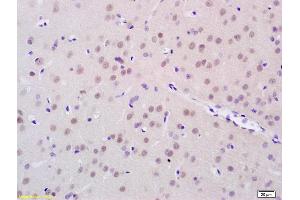 Formalin-fixed and paraffin embedded rat brain tissue labeled with Anti-FTO/Protein Fatso Polyclonal Antibody, Unconjugated (ABIN872957) at 1:200 followed by conjugation to the secondary antibody (FTO Antikörper  (AA 165-265))