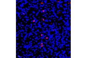 Immunofluorescence of paraffin embedded mouse nephritis using CD177 (ABIN7073372) at dilution of 1:500 (400x lens) (CD177 Antikörper)