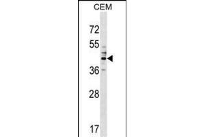 CEAC Antibody (Center) (ABIN1537994 and ABIN2849399) western blot analysis in CEM cell line lysates (35 μg/lane). (CEACAM6 Antikörper  (AA 188-214))