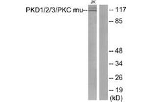 Western blot analysis of extracts from Jurkat cells, using PKD1/2/3/PKC mu (Ab-744/748) Antibody. (PKD1/2/3/PKC mu (AA 706-755) Antikörper)