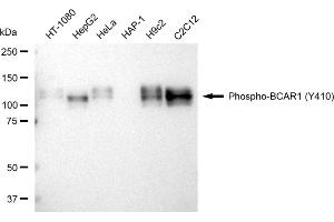 Western blotting analysis using Phospho-BCAR1 (Y410) antibody (ABIN7797792). (Rekombinanter BCAR1 Antikörper  (pTyr410))