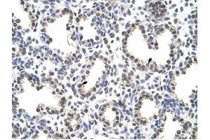 FLJ12529 antibody was used for immunohistochemistry at a concentration of 4-8 ug/ml to stain Alveolar cells (arrows) in Human Lung. (CPSF7 Antikörper  (C-Term))