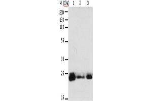 Western Blotting (WB) image for anti-RAB6A, Member RAS Oncogene Family (RAB6A) antibody (ABIN2425552) (RAB6A Antikörper)