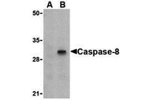 Western Blotting (WB) image for anti-Caspase 8 (CASP8) (C-Term) antibody (ABIN1030320) (Caspase 8 Antikörper  (C-Term))