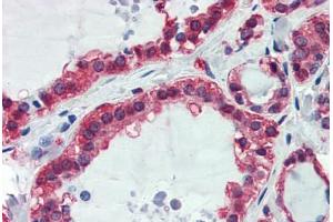 Human Thyroid: Formalin-Fixed, Paraffin-Embedded (FFPE) (GAPDH Antikörper  (AA 9-323))