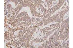 IHC analysis of RAB3GAP2 using anti-RAB3GAP2 antibody (ABIN6719633). (RAB3GAP2 Antikörper  (AA 1-115))