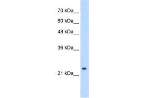 Western Blotting (WB) image for anti-Cleavage and Polyadenylation Specific Factor 4, 30kDa (CPSF4) antibody (ABIN2462224) (CPSF4 Antikörper)