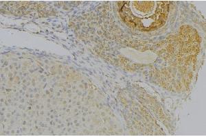 ABIN6277291 at 1/100 staining Human uterus tissue by IHC-P. (NRP2 Antikörper  (N-Term))