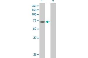 Western Blot analysis of ACHE expression in transfected 293T cell line by ACHE MaxPab polyclonal antibody. (Acetylcholinesterase Antikörper  (AA 1-640))