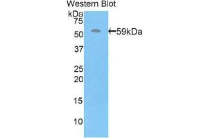 Western Blotting (WB) image for anti-Perforin 1 (Pore Forming Protein) (PRF1) (AA 32-316) antibody (ABIN1860311)