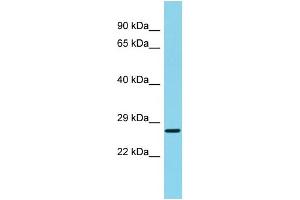 Host: Rabbit Target Name: C22orf13 Sample Type: Fetal Liver lysates Antibody Dilution: 1. (C22orf13 Antikörper  (C-Term))