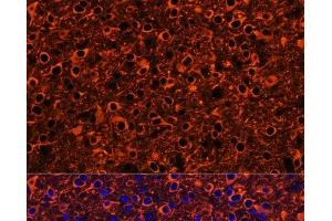 Immunofluorescence analysis of Mouse brain using TUBB3 Polyclonal Antibody at dilution of 1:100. (TUBB3 Antikörper)