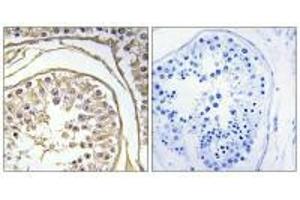 Immunohistochemistry analysis of paraffin-embedded human testis tissue using BAGE2 antibody. (BAGE2 Antikörper)