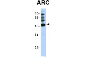 Host:  Rabbit  Target Name:  ARC  Sample Type:  293T  Antibody Dilution:  1. (ARC (Middle Region) Antikörper)
