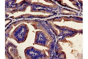 Immunohistochemistry analysis of human prostate tissue using ABIN7174228 at dilution of 1:100 (Ubiquilin 2 Antikörper  (AA 473-542))