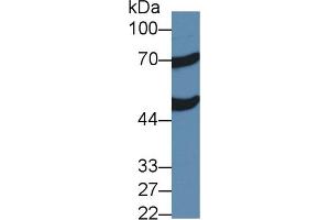 Detection of ACOX1 in Mouse Liver lysate using Polyclonal Antibody to Acyl Coenzyme A Oxidase 1, Palmitoyl (ACOX1) (ACOX1 Antikörper  (AA 210-409))