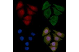 ABIN6259232 and ABIN6275659 staining Hela cells by IF/ICC. (USP45 Antikörper  (Internal Region))