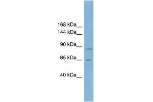 WB Suggested Anti-MGC16169 Antibody Titration:  0. (TBCK Antikörper  (Middle Region))