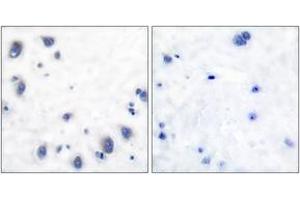 Immunohistochemistry analysis of paraffin-embedded human brain tissue, using Tyrosine Hydroxylase (Ab-40) Antibody. (Tyrosine Hydroxylase Antikörper  (AA 41-90))