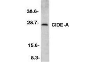 Western blot analysis of CIDE-A in mouse heart tissue lysate with AP30230PU-N CIDE-A antibody at 1/500 dilution. (CIDEA Antikörper  (C-Term))