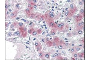 Human Liver (formalin-fixed, paraffin-embedded) stained with PCK1at 2 µg/ml followed by biotinylated anti-goat IgG secondary antibody, alkaline phosphatase-streptavidin and chromogen. (PCK1 Antikörper  (Internal Region))