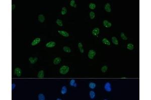 Immunofluorescence analysis of U-2 OS cells using MKL1 Polyclonal Antibody at dilution of 1:100 (40x lens).