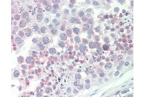 Anti-IGFBP1 antibody IHC staining of human testis. (IGFBPI Antikörper  (AA 156-170))