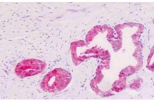 Human Prostate, Epithelium: Formalin-Fixed, Paraffin-Embedded (FFPE)