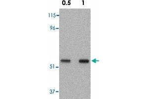 Western blot analysis of SKIL in A-431 cell lysate with SKIL polyclonal antibody  at 0.