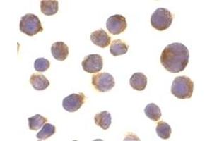 Image no. 2 for anti-Tumor Necrosis Factor Receptor Superfamily, Member 10a (TNFRSF10A) (C-Term) antibody (ABIN201644) (TNFRSF10A Antikörper  (C-Term))