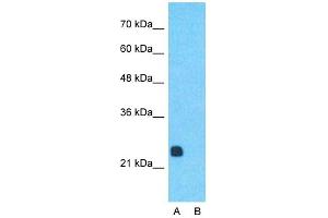 Host:  Rabbit  Target Name:  RCAN1  Sample Type:  Human Fetal Muscle  Lane A:  Primary Antibody  Lane B:  Primary Antibody + Blocking Peptide  Primary Antibody Concentration:  1ug/ml  Peptide Concentration:  5ug/ml  Lysate Quantity:  25ug/lane/lane  Gel Concentration:  0. (RCAN1 Antikörper  (Middle Region))