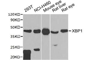 Western blot All lanes: XBP1 antibody at 1:1000 dilution Lane 1: 293T whole cell lysate Lane 2: NCI-H460 whole cell lysate Lane 3: Mouse eye tissue Lane 4: Rat liver tissue Lane 5: Rat eye tissue Secondary Goat polyclonal to rabbit IgG at 1/10000 dilution Predicted band size: 29, 41 kDa Observed band size: 41 kDa (XBP1 Antikörper  (AA 1-261))