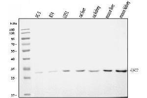 Western blot analysis of GJB2 using anti-GJB2 antibody (ABIN7603054).