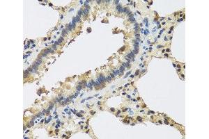 Immunohistochemistry of paraffin-embedded Rat lung using IL25 Polyclonal Antibody at dilution of 1:100 (40x lens). (IL-25 Antikörper)