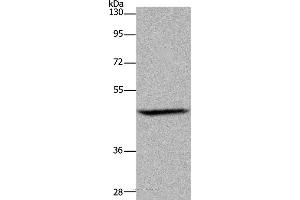 Western blot analysis of Mouse brain tissue, using ETS2 Polyclonal Antibody at dilution of 1:500 (ETS2 Antikörper)