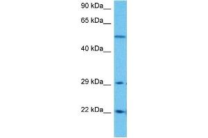 Host:  Rabbit  Target Name:  SLC25A4  Sample Tissue:  Human DLD1 Whole Cell  Antibody Dilution:  1ug/ml (SLC25A4 Antikörper  (N-Term))