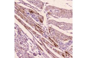 IHC analysis of ANP using anti-ANP antibody (ABIN5693163).