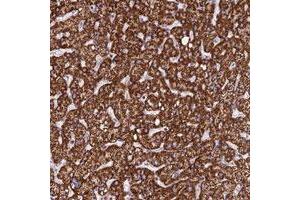 Immunohistochemical staining of human liver with PPP1R12C polyclonal antibody  shows strong cytoplasmic positivity in hepatocytes. (PPP1R12C Antikörper)
