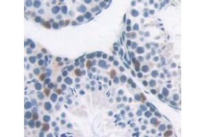 Used in DAB staining on fromalin fixed paraffin- embedded testis tissue (BRD1 Antikörper  (AA 579-1058))