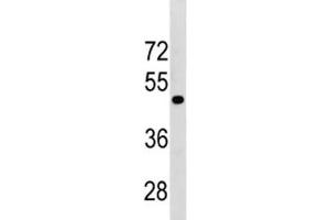 Western Blotting (WB) image for anti-Transforming Growth Factor, beta Receptor 1 (TGFBR1) (AA 145-172) antibody (ABIN3029223)