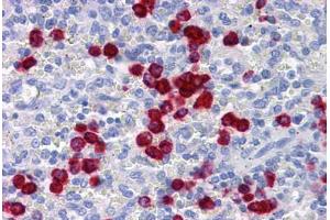 Immunohistochemistry (Formalin-fixed Paraffin-embedded Sections) (IHC (fp)) image for anti-Cadherin 18, Type 2 (CDH18) (AA 467-577) antibody (ABIN574223)