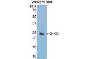 Western Blotting (WB) image for anti-Fc Fragment of IgE, Low Affinity II, Receptor For (CD23) (FCER2) (AA 150-330) antibody (ABIN1174800) (FCER2 Antikörper  (AA 150-330))