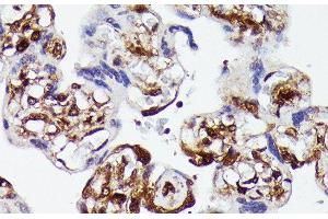 Immunohistochemistry of paraffin-embedded Human placenta using YAP1 Polyclonal Antibody at dilution of 1:100 (40x lens). (YAP1 Antikörper)