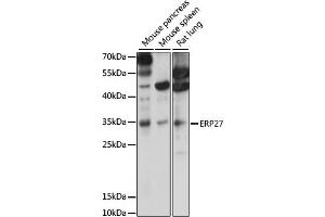 Western blot analysis of extracts of various cell lines, using ERP27 antibody (ABIN7266942) at 1000 dilution. (ERP27 Antikörper  (AA 1-273))